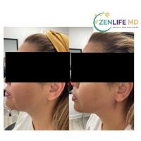 Zenlife MD image 4